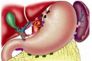 胆中危机（下）