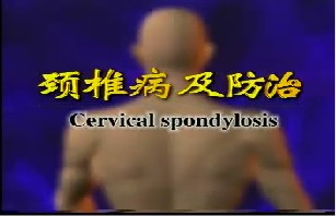 颈椎病及防治