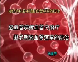 脑血管病介入治疗围术期脑血管痉挛的防治