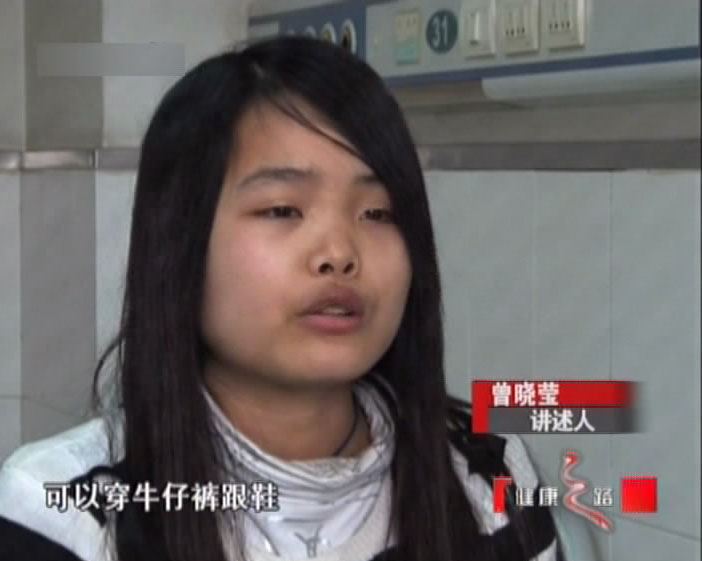 健康之路—象腿女孩