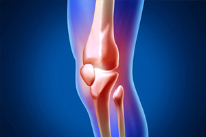 骨刺之痛（上）