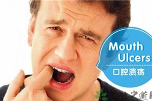 口腔溃疡之痛（中）