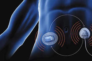 生死胰腺牵（下）